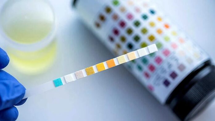 Contraloría detecta irregularidades en compra de insumos médicos por la Red de Salud Puno