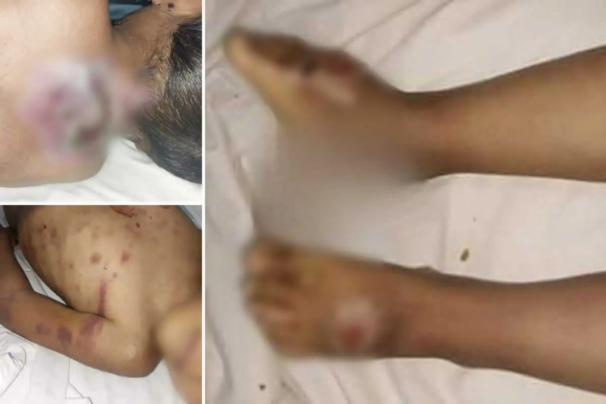 Puno conmemora primer año de fallecimiento del pequeño Sebastián de 5 años, víctima de tortura